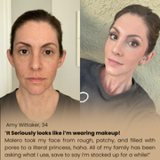 Official GlowRice Peel Shot Exfoliator - Full Duo