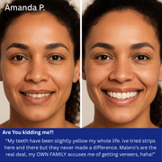 GetWhite™ 7-Day Treatment: Teeth Whitening Strips