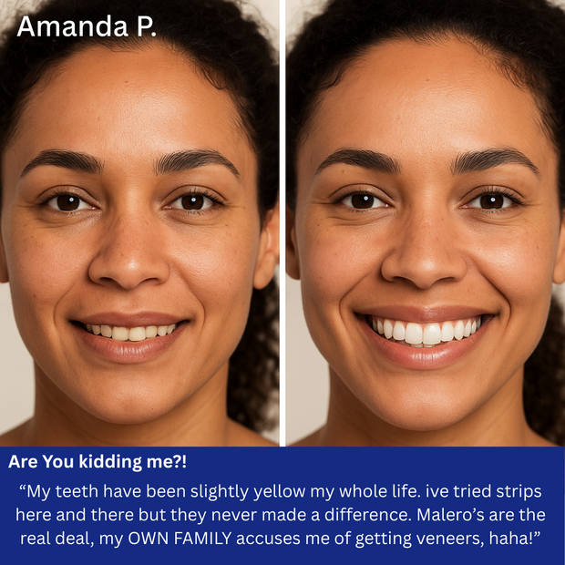 GetWhite™ 7-Day Treatment: Teeth Whitening Strips